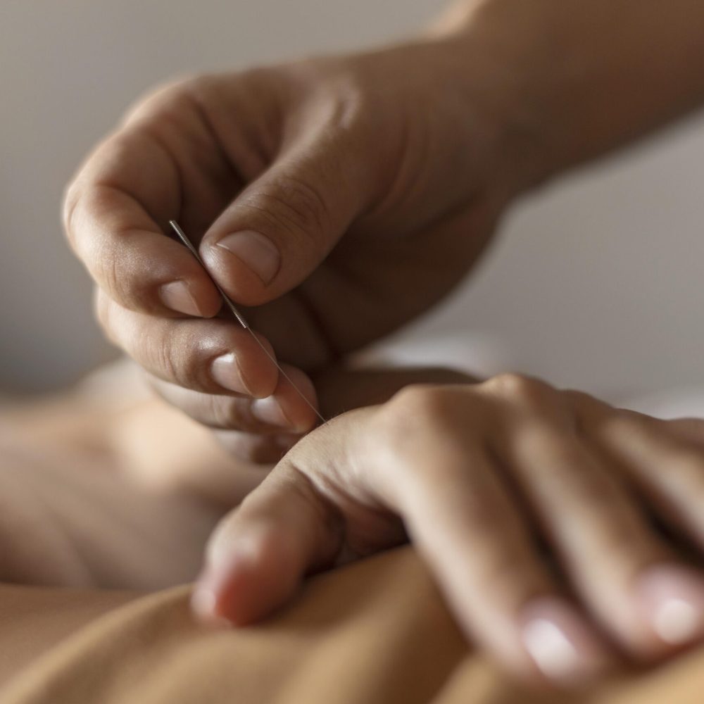 close-up-hand-holding-acupuncture-needle (2)